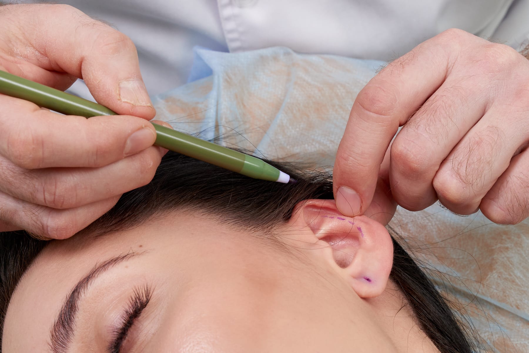 chirurgie des oreilles aix-en-provence - MARINELLI luca - chirurgien de la face et du cou