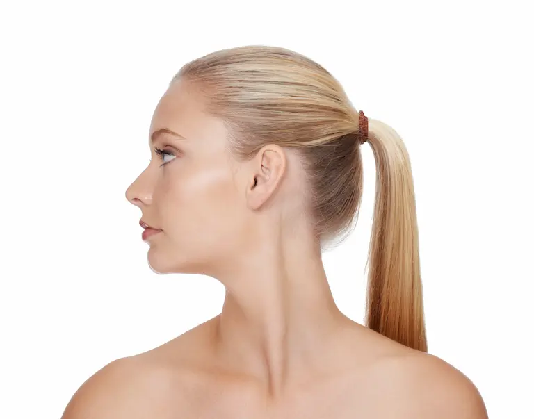ponytail lift dr luca marinelli aix en provence jeune femme de profil avec une queue de cheval