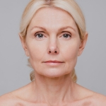 Illustration des trois interventions du regard : blépharoplastie supérieure, lifting temporal du sourcil et lifting ponytail