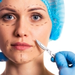 Chirurgien réalisant un lifting endoscopique du visage avec endoscope, incisions minimes dans le cuir chevelu