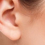 Illustration des oreilles avant et après otoplastie, avec comparaison entre chirurgie classique et technique EarFold